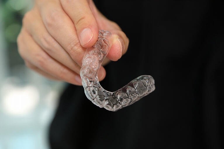 前歯の部分矯正のメリット・デメリット